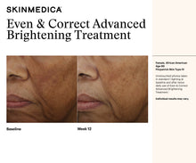 Load image into Gallery viewer, Even & Correct Advanced Brightening Treatment