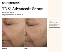 Load image into Gallery viewer, Skin Medica TNS Advanced+ Serum
