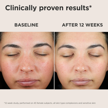 Load image into Gallery viewer, EltaMD UV Skin Recovery Red Color Correcting GREEN Tint Broad Spectrum SPF 50
