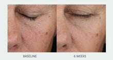Load image into Gallery viewer, Derm Naturals Retinol Forte Renewal Serum 5x
